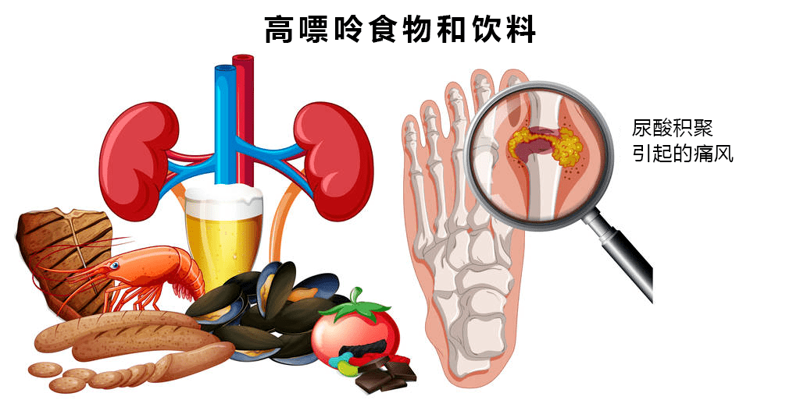 盘锦痛风专家引领健康生活变革