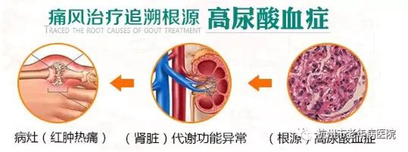 盘锦痛风就医指南：如何选择合适的医院与科室
