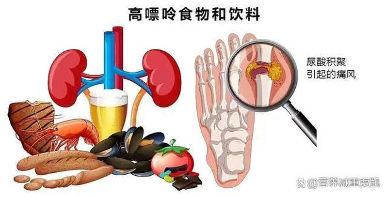 盘锦痛风专科医院：为您点亮健康明灯