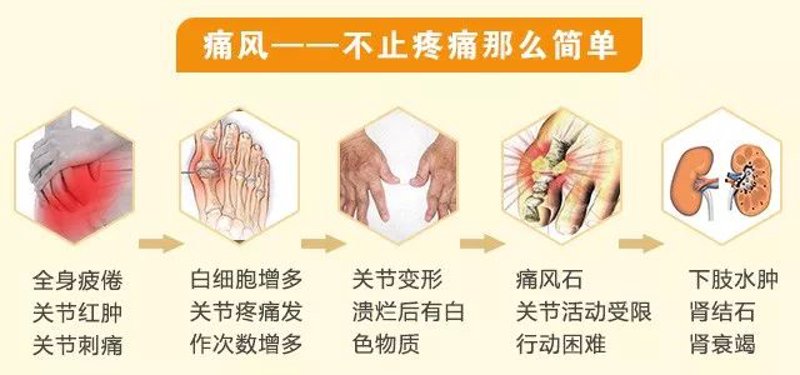 盘锦痛风医院助力患者远离痛风困扰